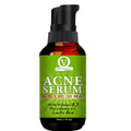 Vital Organics Acne Serum | Grocsy