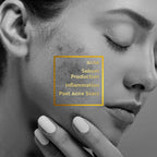 VLCC Clinic Acne Control Regime CSMS (Cleanser, Serum, Moisturizer, Sunscreen) For Acne Care Combo | Grocsy