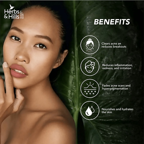 Herbs & Hills Anti Acne Face Pack | Grocsy
