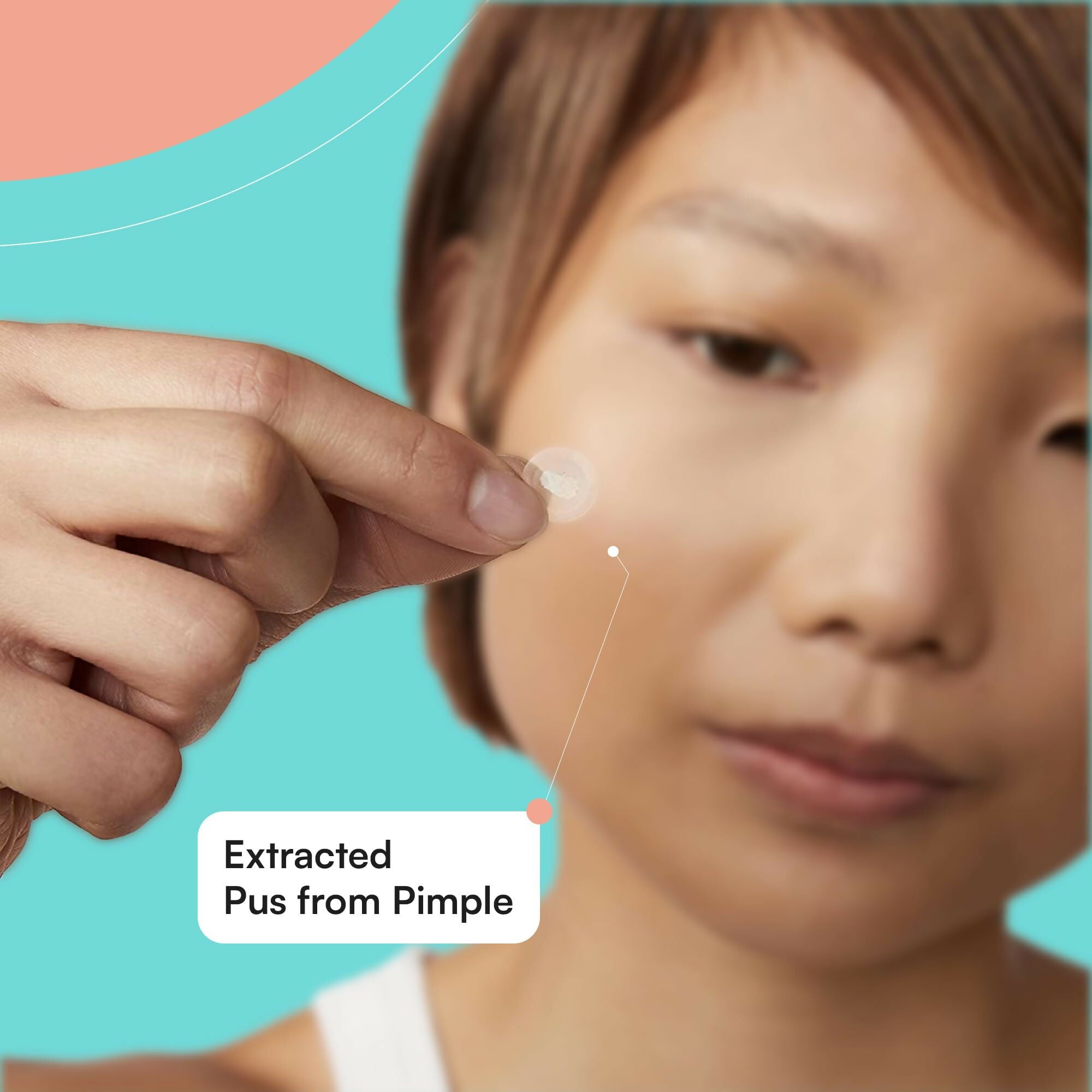 Xokit Pimple Patches for Face, Hydrocolloid Acne Patch for Acne Treatment - Invisible Facial Stickers Covers | Grocsy
