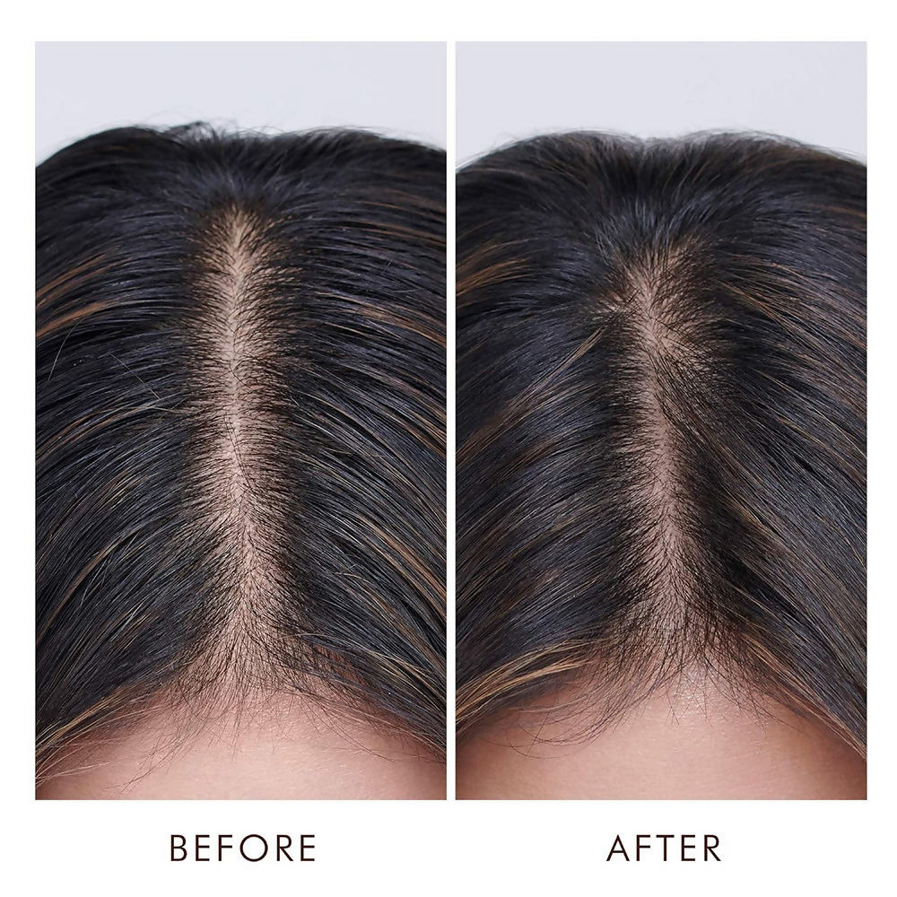 Moroccanoil Oily Scalp Treatment For Oily, Imbalanced Scalps | Grocsy