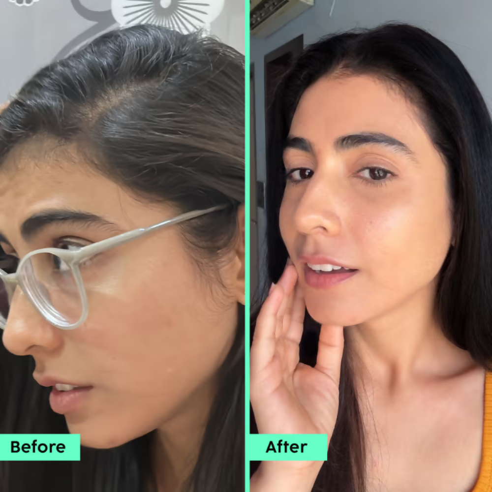 PLIX The Plant Fix Rosemary Advanced Hair Kit | Grocsy
