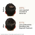 Professional O3+ Men Densiderm Anti Hair Loss Shampoo For Dense Hair & Regrowth | Grocsy