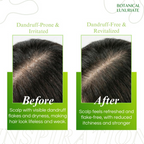 Botanical Luxuriate Amla & Rosemary Anti-Dandruff Shampoo | Grocsy