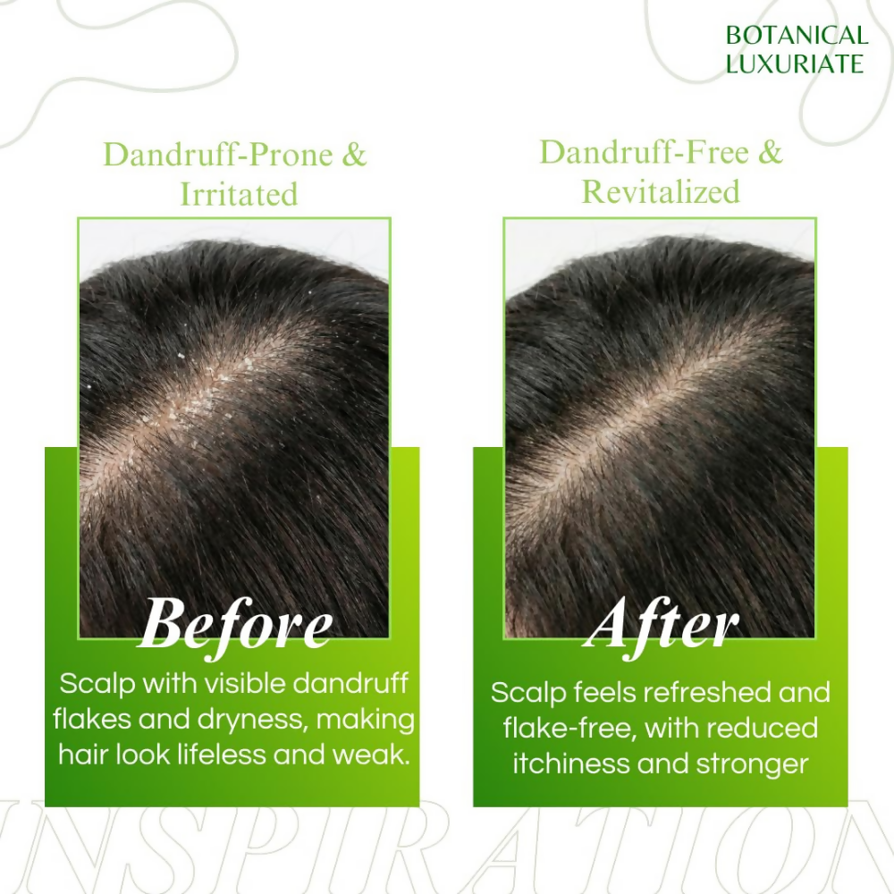 Botanical Luxuriate Amla & Rosemary Anti-Dandruff Shampoo | Grocsy