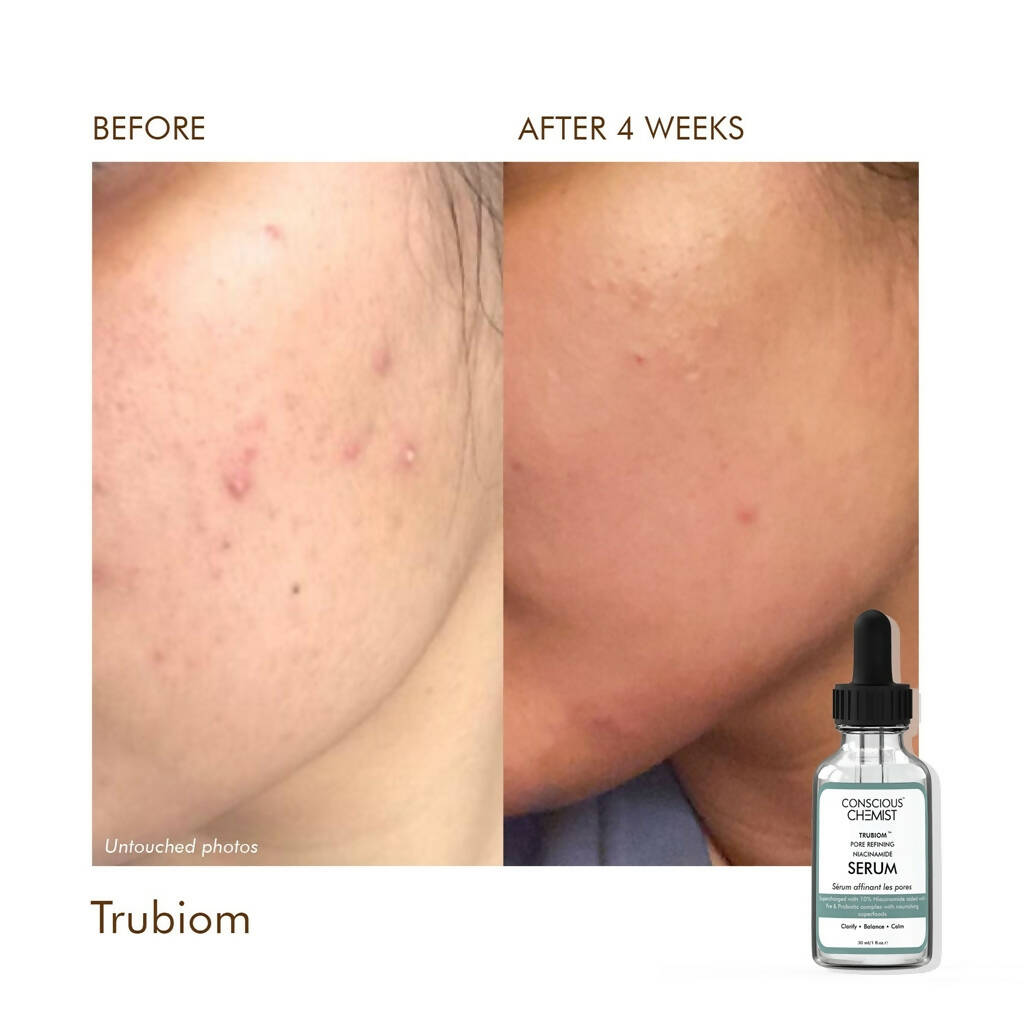 Conscious Chemist Trubiom Pore Refining Niacinamide Serum | Grocsy