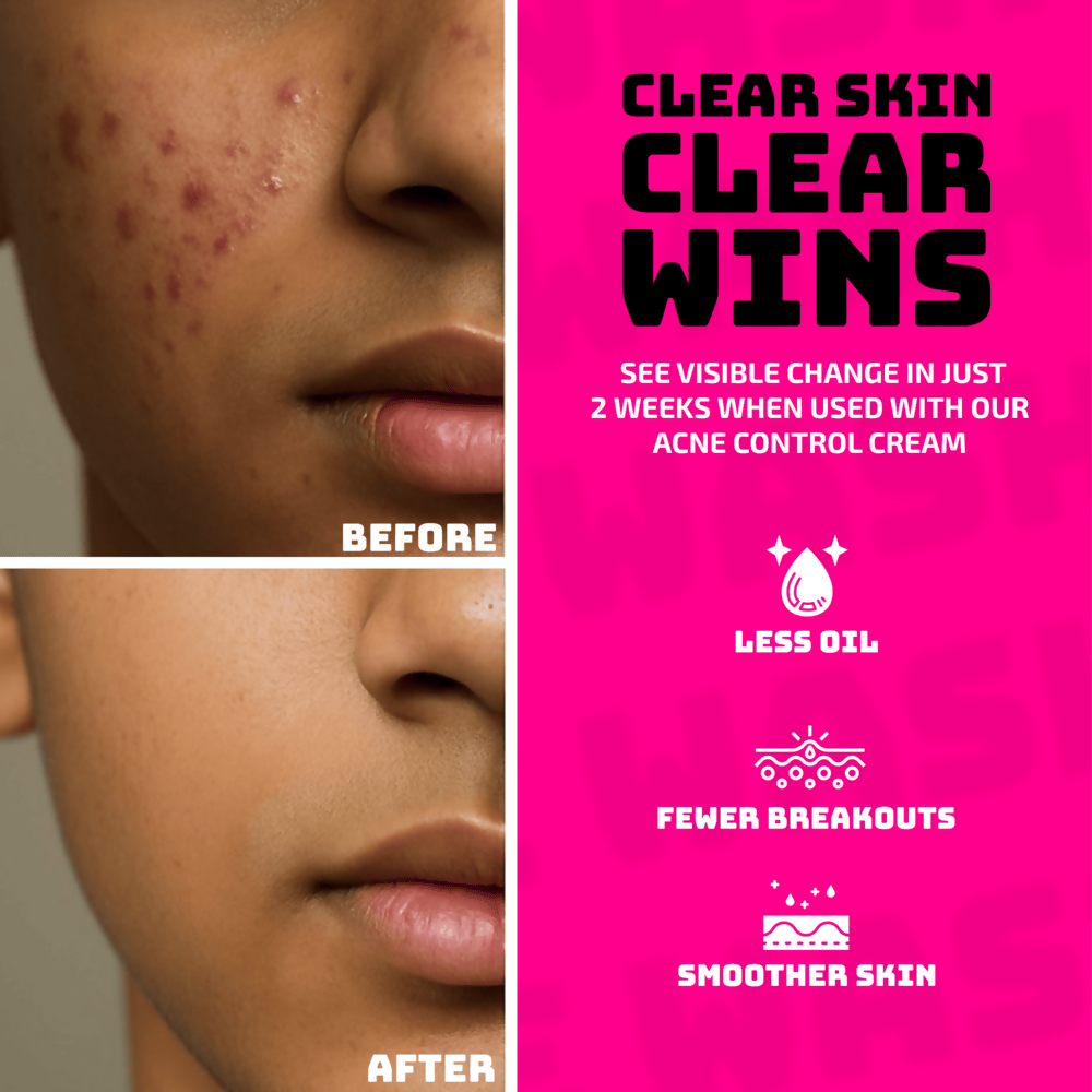Elemen Anti-Acne Face Wash | Grocsy