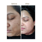 Personal Touch Mucin Serum With Hyaluronic Acids, Ceramides & Niacinamide | Grocsy