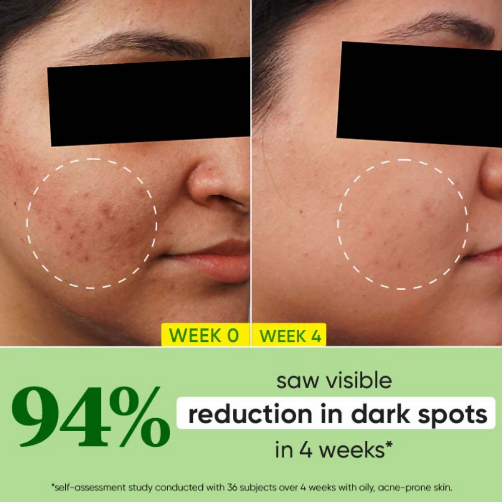 Dot & Key 10% Niacinamide Cica Face Serum | Grocsy