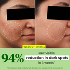 Dot & Key 10% Niacinamide Cica Face Serum | Grocsy