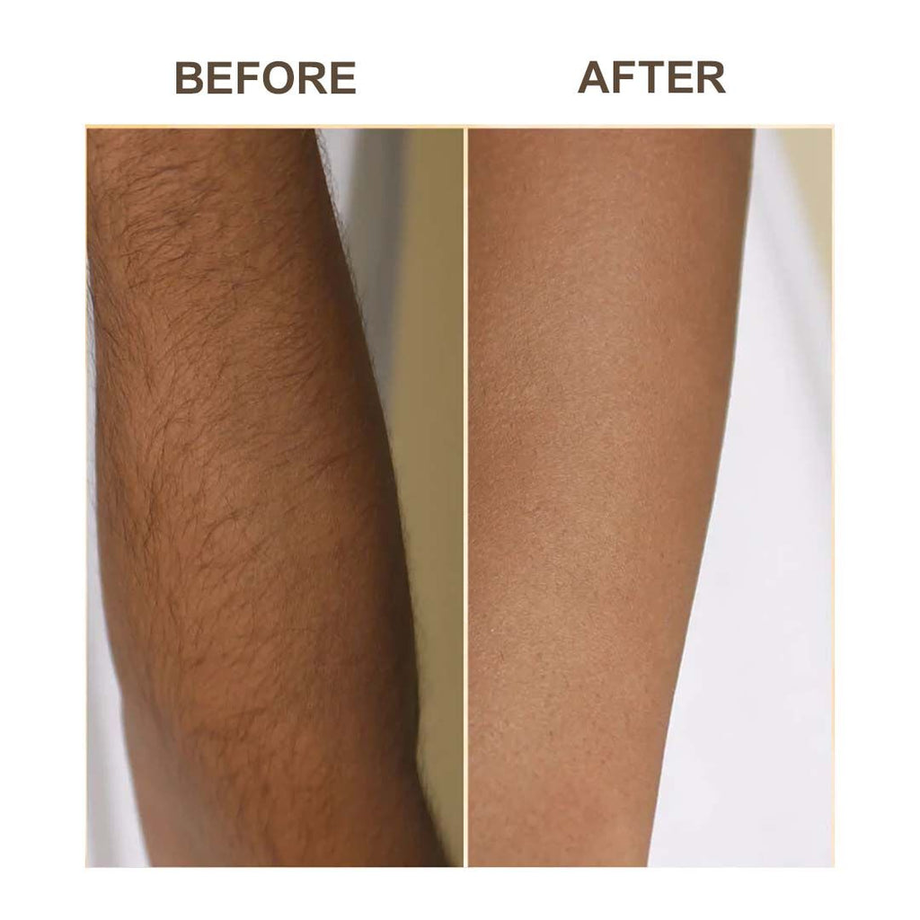 Samisha Haldi Hair Removal Powder | Grocsy
