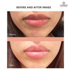 Samisha Beetroot Lip Lightening Scrub | Grocsy