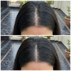 Vedicderm Psoriasis Oil 2-in-1 Skin + Scalp Relief Oil | Grocsy