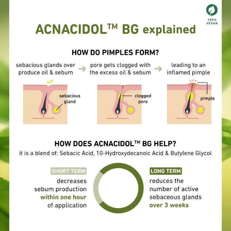 Plum Green Tea & 3% Zinc Complex Face Serum with Acnacidol BG - Fights Acne, Pimples & Controls Oil | Grocsy