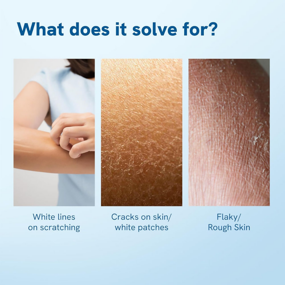 BeBodywise 10% Urea Body Lotion | Grocsy