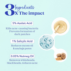 Blue Heaven Acne Clear Serum with 5% Azelaic Acid +1% Salicylic Acid + 0.5% Nutmeg Oil | Grocsy
