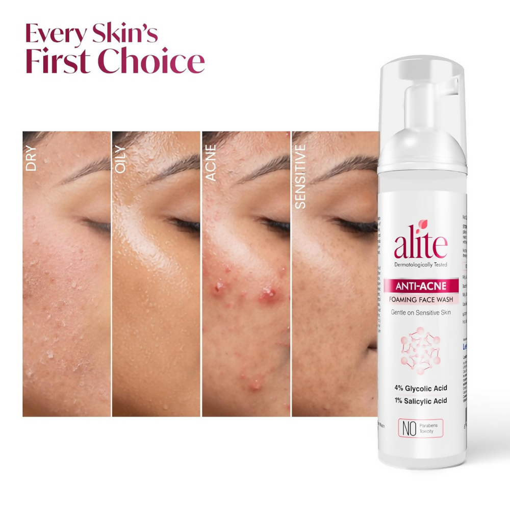 Alite Anti Acne 5-in-1 Foaming Face Wash with 4% Glycolic Acid & 1% Salicylic Acid | Grocsy