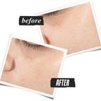 Kiehl's Ultra Pure High-Potency Serum with 1.5% Hyaluronic Acid | Grocsy