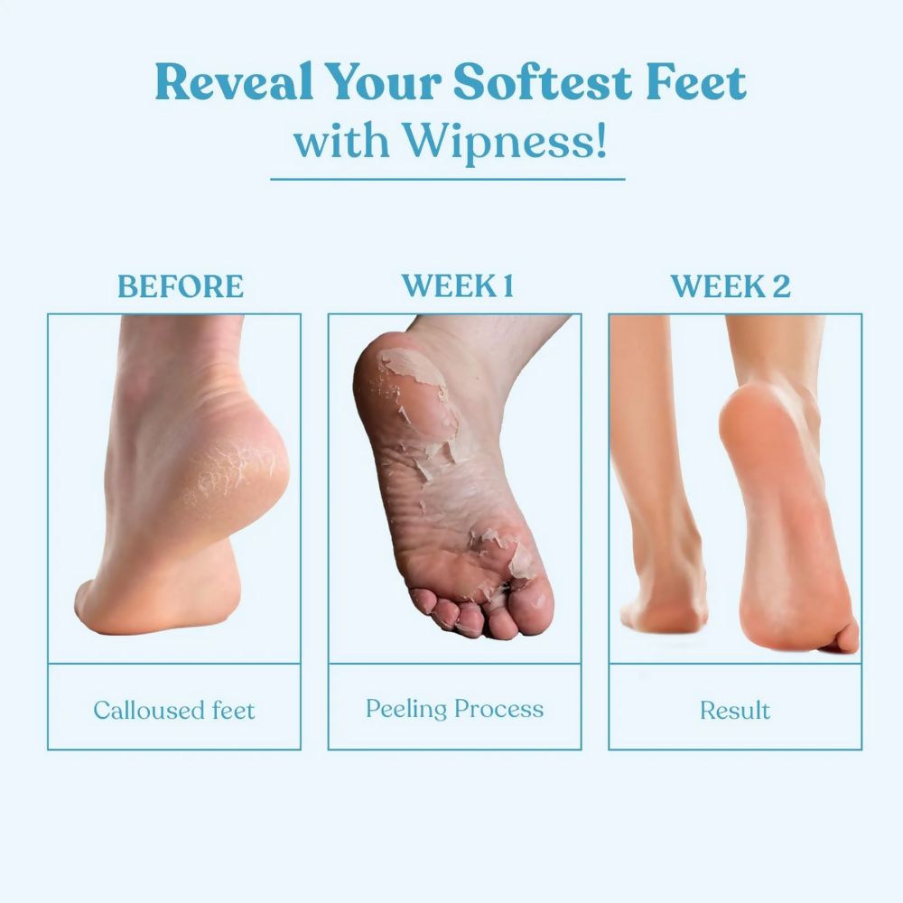 Wipness Natural Foot Peeling & Exfoliating Foot Mask | Grocsy
