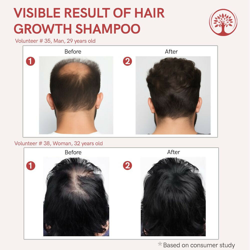 Ivory Natural Hair Shampoo For Growth - Hair Wellness & Nourishment For Both Men And Women | Grocsy