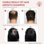 Ivory Natural Hair Shampoo For Growth - Hair Wellness & Nourishment For Both Men And Women | Grocsy