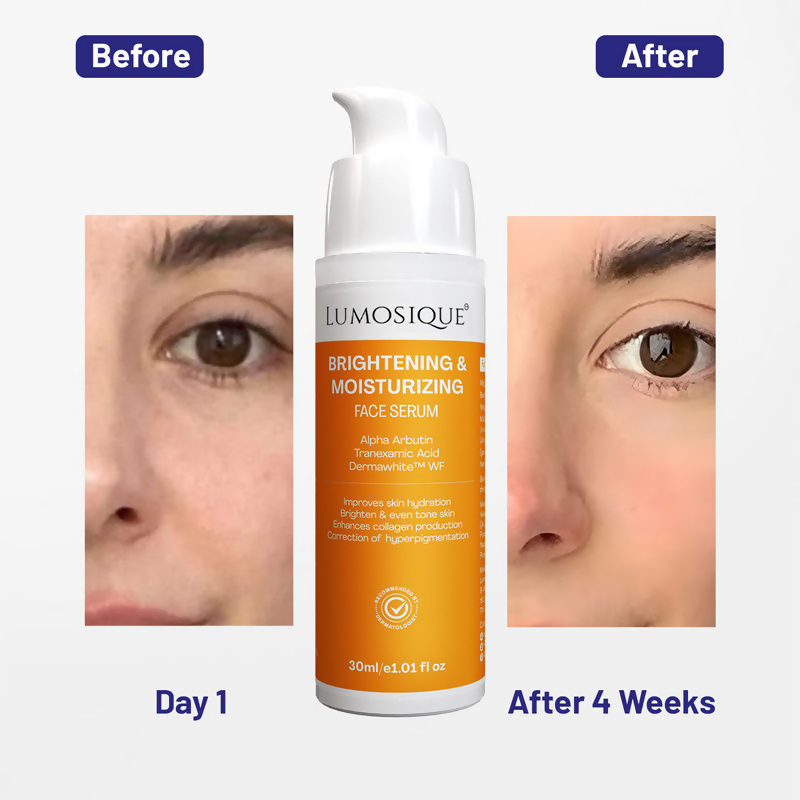 Lumosique Brightening And Moisturizing Face Serum | Grocsy