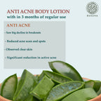 Buddha Natural Anti Acne Body Lotion - For Help Clear Acne & Future Breakouts | Grocsy