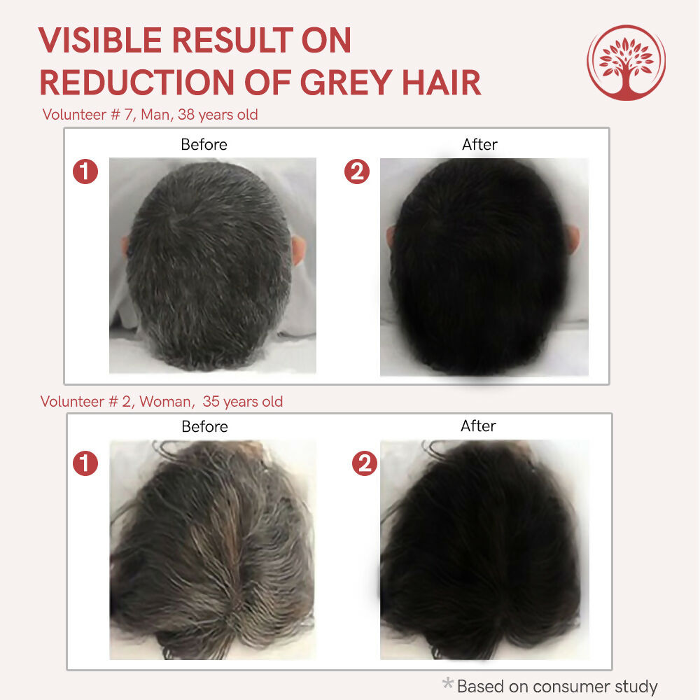 Ivory Natural Grey Hair Serum - Restore Natural Hair Color | Grocsy