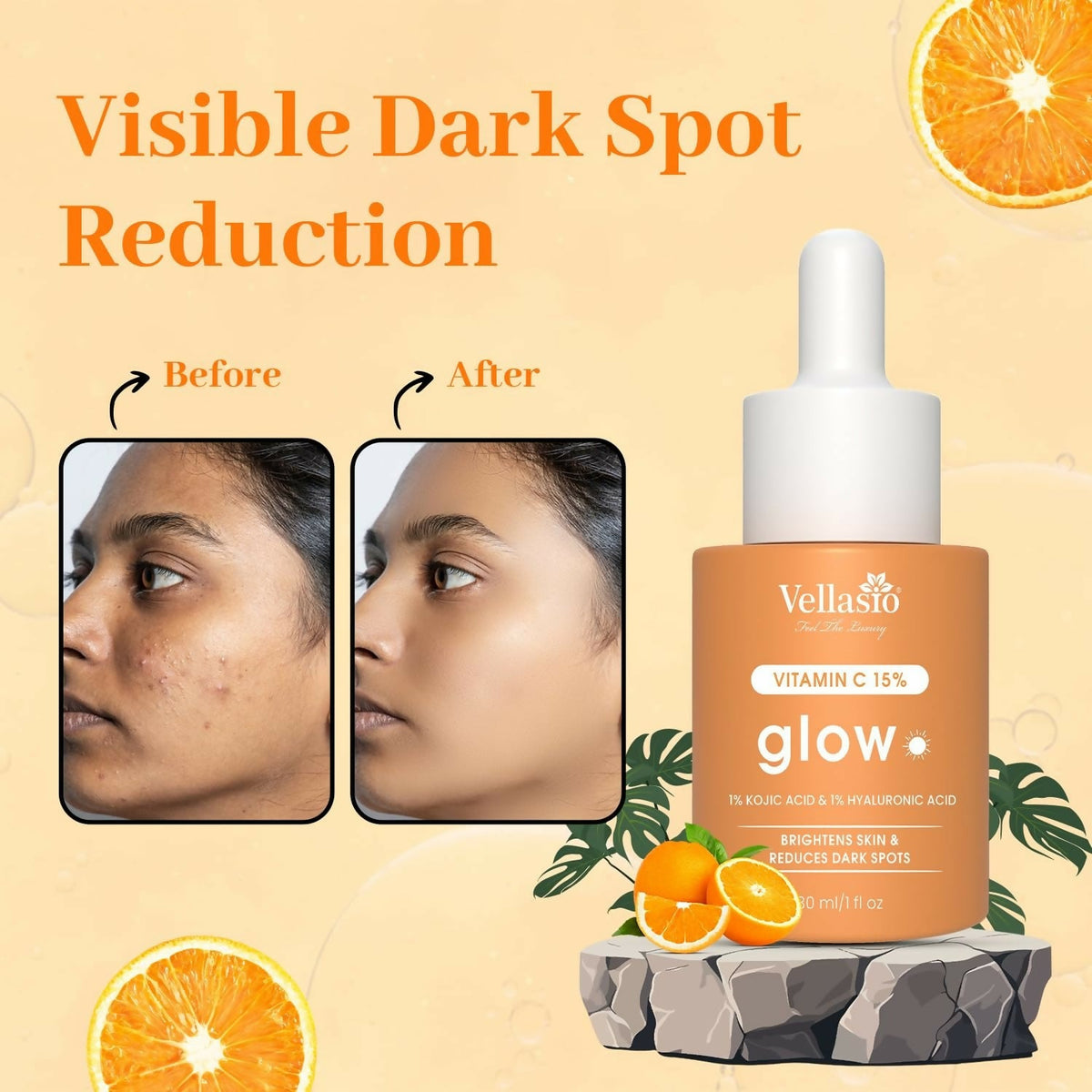 Vellasio 15% Vitamin C Serum with Hyaluronic Acid & Kojic Acid | Grocsy