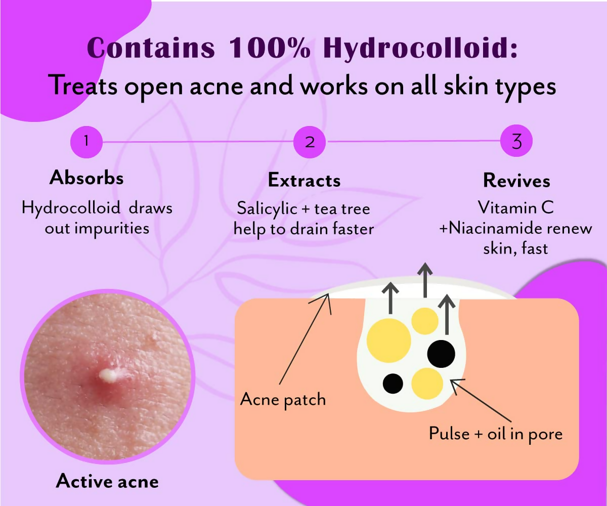 Urban Yog Acne Curvy Pimple Patch - Invisible Facial Stickers cover | Grocsy