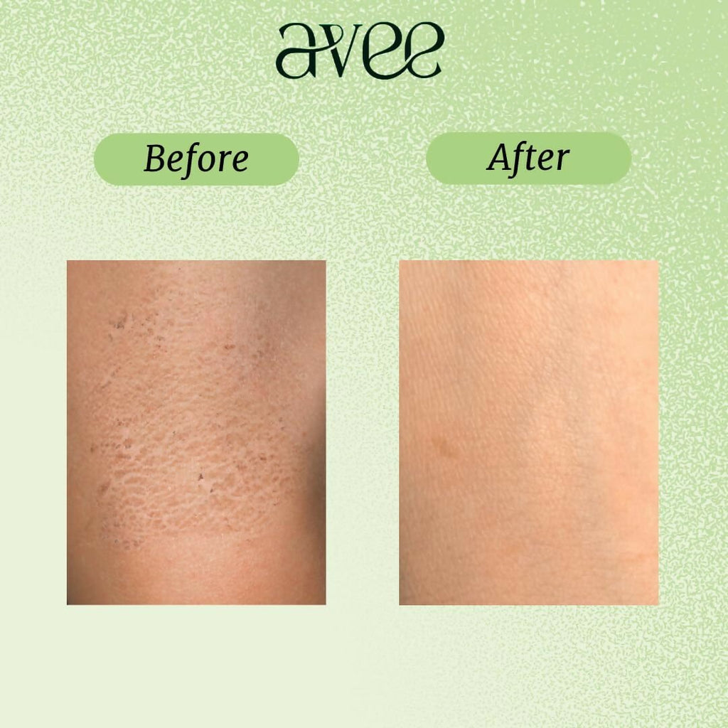 Avee Kids Daily Body Lotion for Kids 5-12 Yrs with Oats, Vitamins B5 & E, Shea & Cocoa Butter, Non-Greasy, Deep Hydration | Grocsy