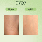 Avee Kids Daily Body Lotion for Kids 5-12 Yrs with Oats, Vitamins B5 & E, Shea & Cocoa Butter, Non-Greasy, Deep Hydration | Grocsy