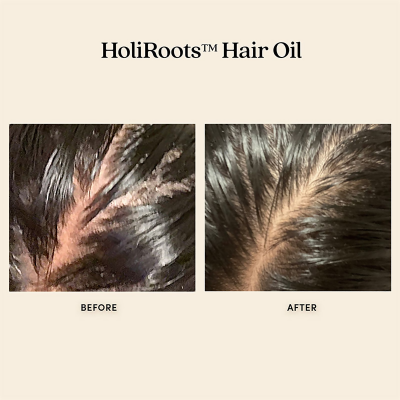 Fable & Mane HoliRoots Oil To Strengthen Roots and Thicken Hair | Grocsy