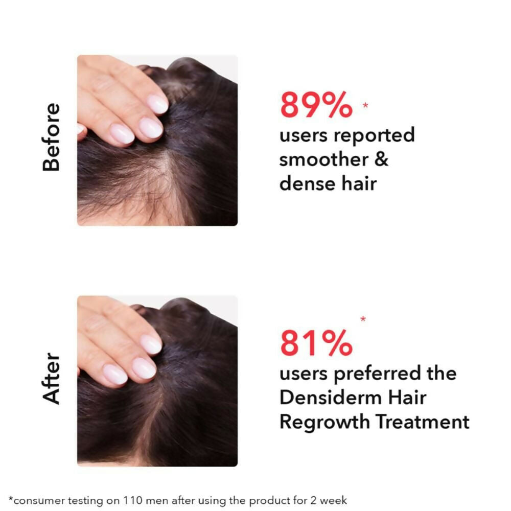 Professional O3+ Women Densiderm Hair Growth Scalp Serum Spray For Anti Hair Loss With Ginseng | Grocsy