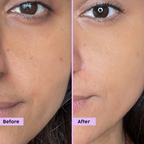 PLIX The Plant Fix - Jamun Active Acne Regime With Cleanser & Toner To Unclog Pores & Reduce Acne | Grocsy