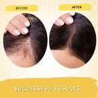 Mystiq Living Rosemary Hair Growth Serum | Grocsy