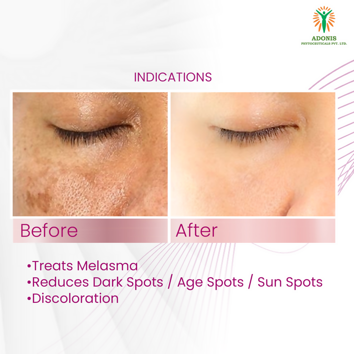Adonis Ad Mela Tx Cream | Grocsy