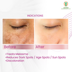Adonis Ad Mela Tx Cream | Grocsy
