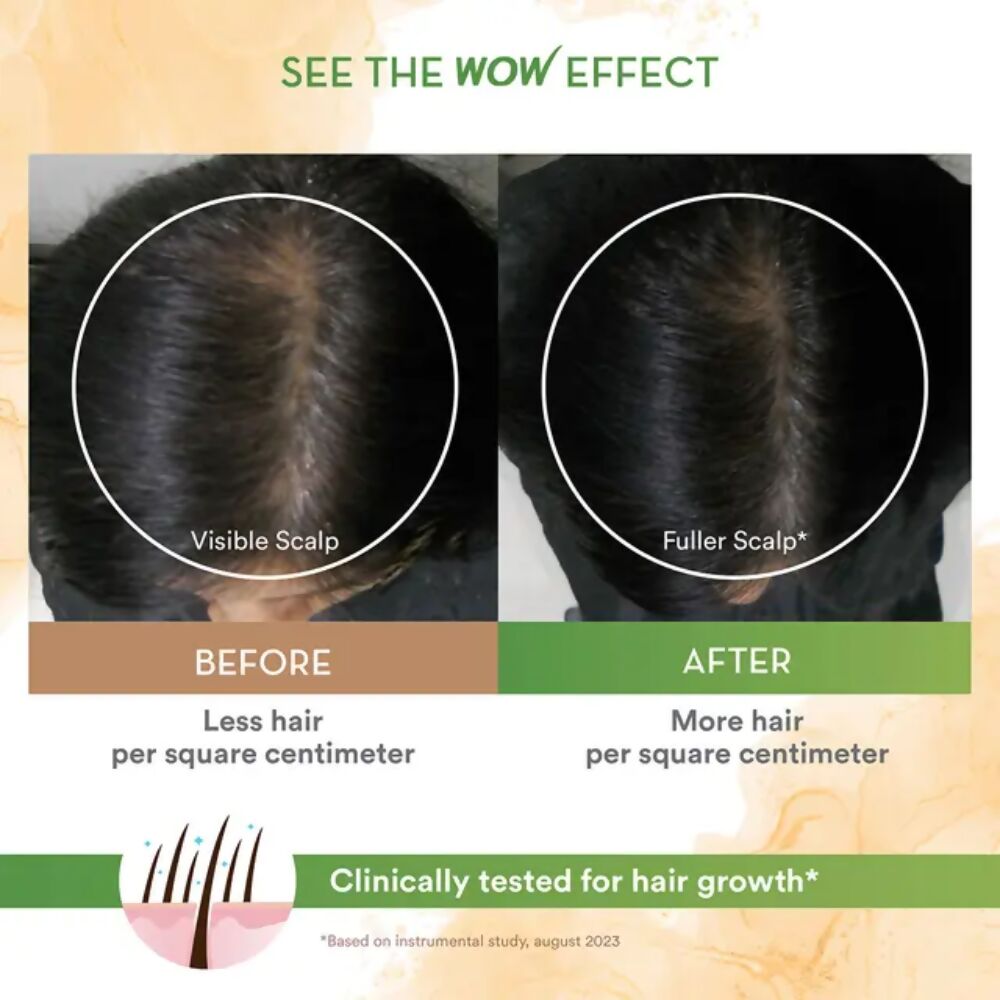Wow Life Science Rosemary With Biotin Hair Serum | Grocsy