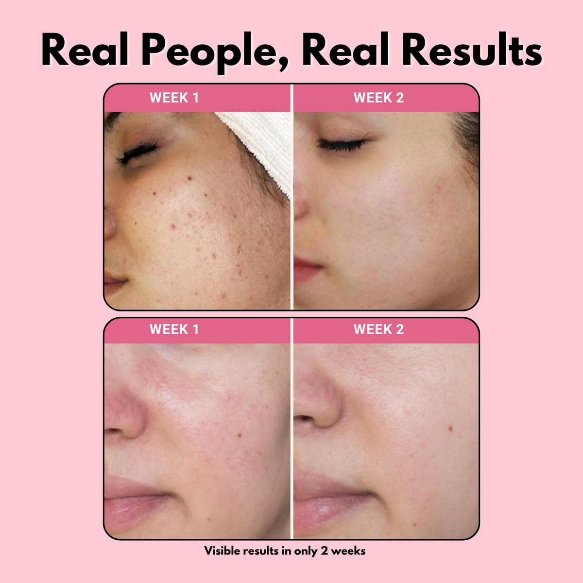 FSAS Health and Beauty Face Combo of Face Hydrator + Green Tea Foaming Face Cleanser | Grocsy