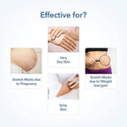 The Moms Co Stretch Marks Bundle | Grocsy