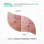 SkinInspired AcNil3 Rapid Spot Corrector | Grocsy