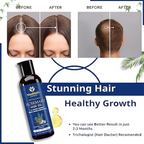 Moolveda 100% Pure Rosemary Hair Oil for Hair Growth | Grocsy