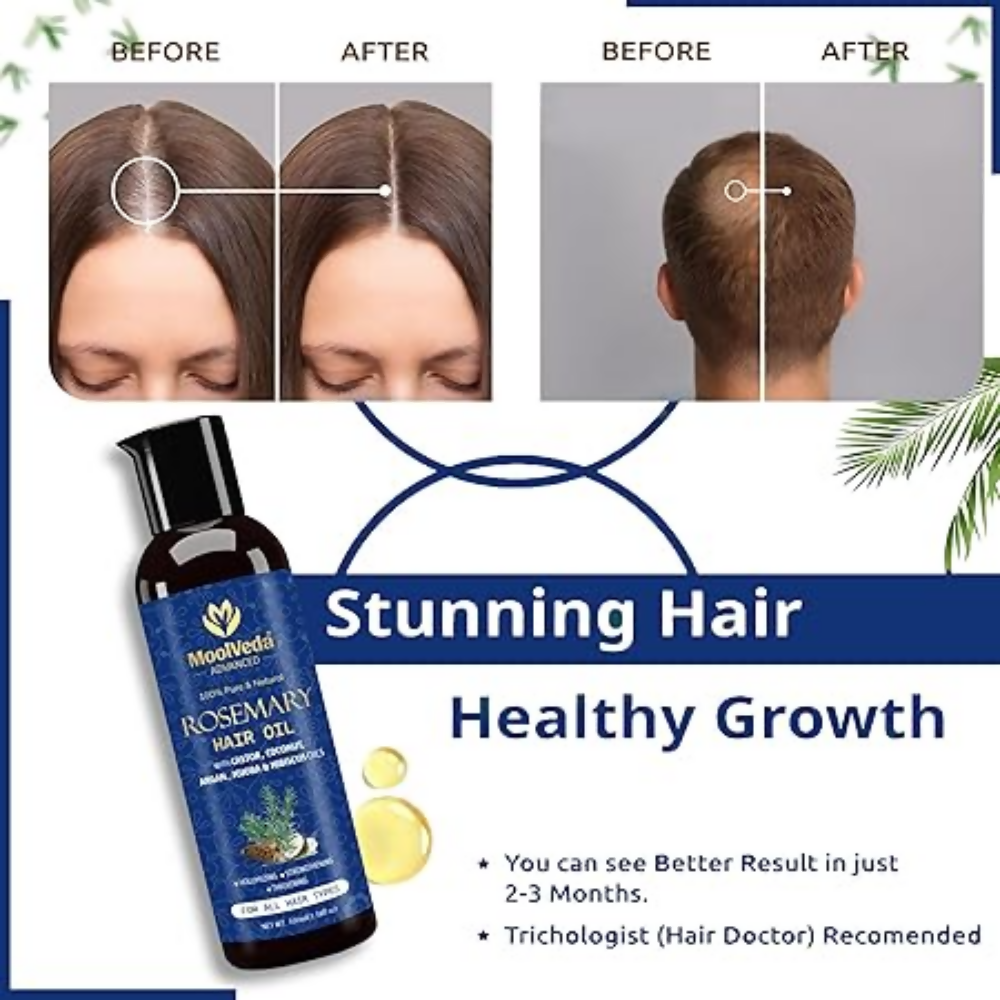 Moolveda 100% Pure Rosemary Hair Oil for Hair Growth | Grocsy