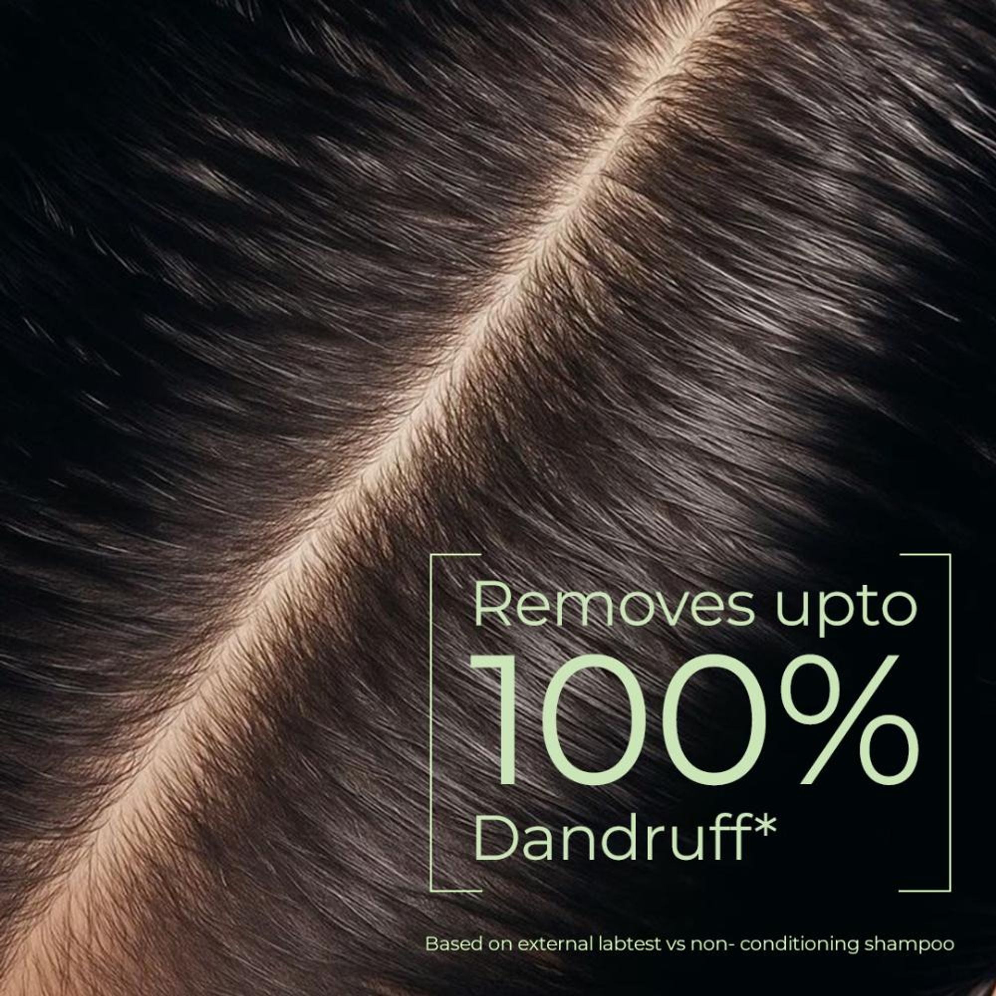 Naturali Dandruff Defence Shampoo With Cactus Extract, Tea Tree Oil & Climbazole | Grocsy