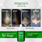 Lakshmi Krishna Naturals Redensyl Advanced Hair Growth Serum | Grocsy