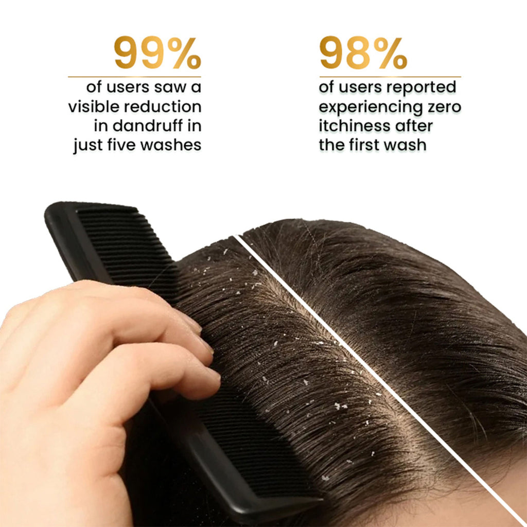The Skin Story Anti Dandruff Deep Ceansing Shampoo Calms & Soothes Scalp With Saniscalp & Argan Oil | Grocsy