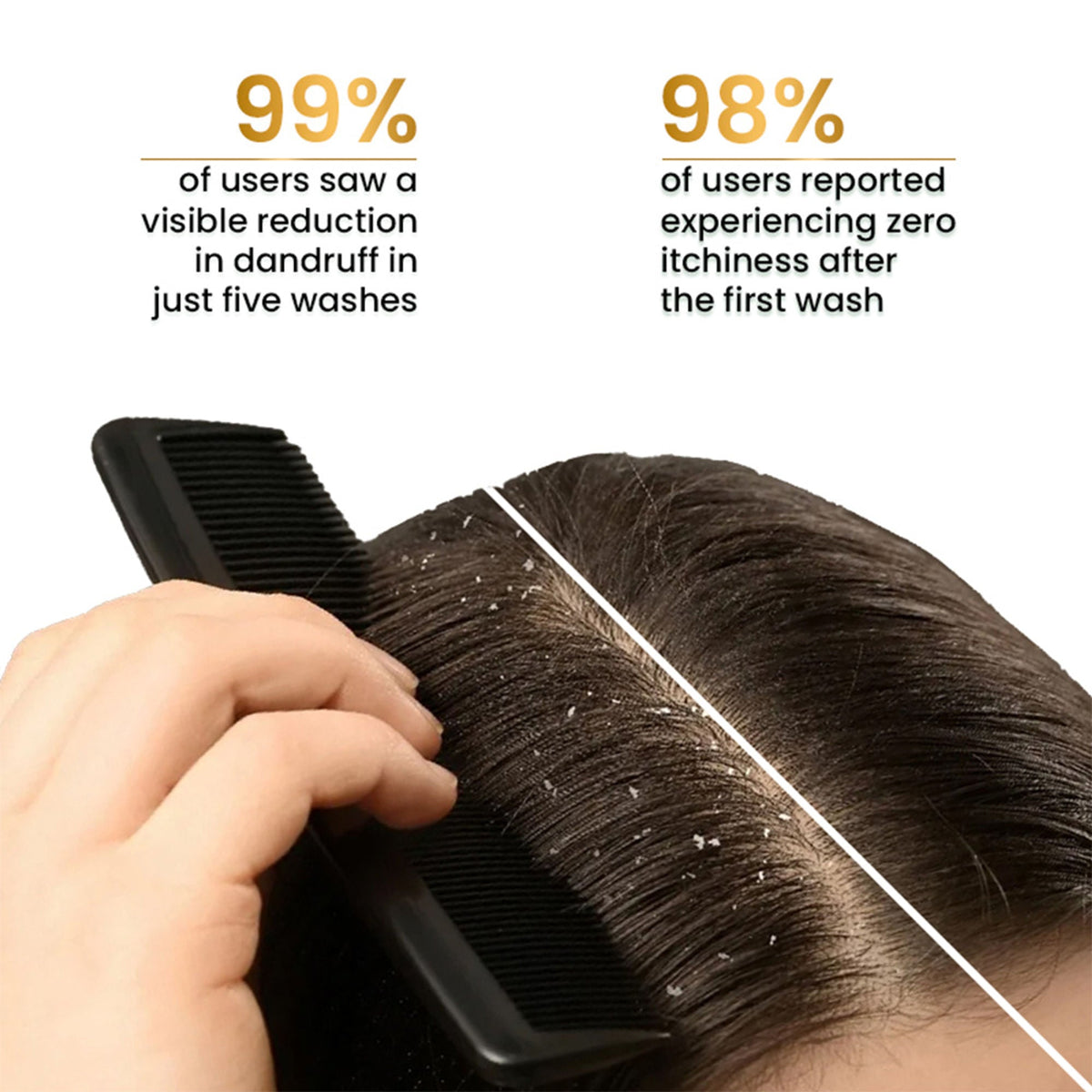 The Skin Story Anti Dandruff Deep Ceansing Shampoo Calms & Soothes Scalp With Saniscalp & Argan Oil | Grocsy