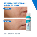 CeraVe Resurfacing Retinol Serum, Reduces Acne Marks with Licorice Root Extract & Niacinamide | Grocsy