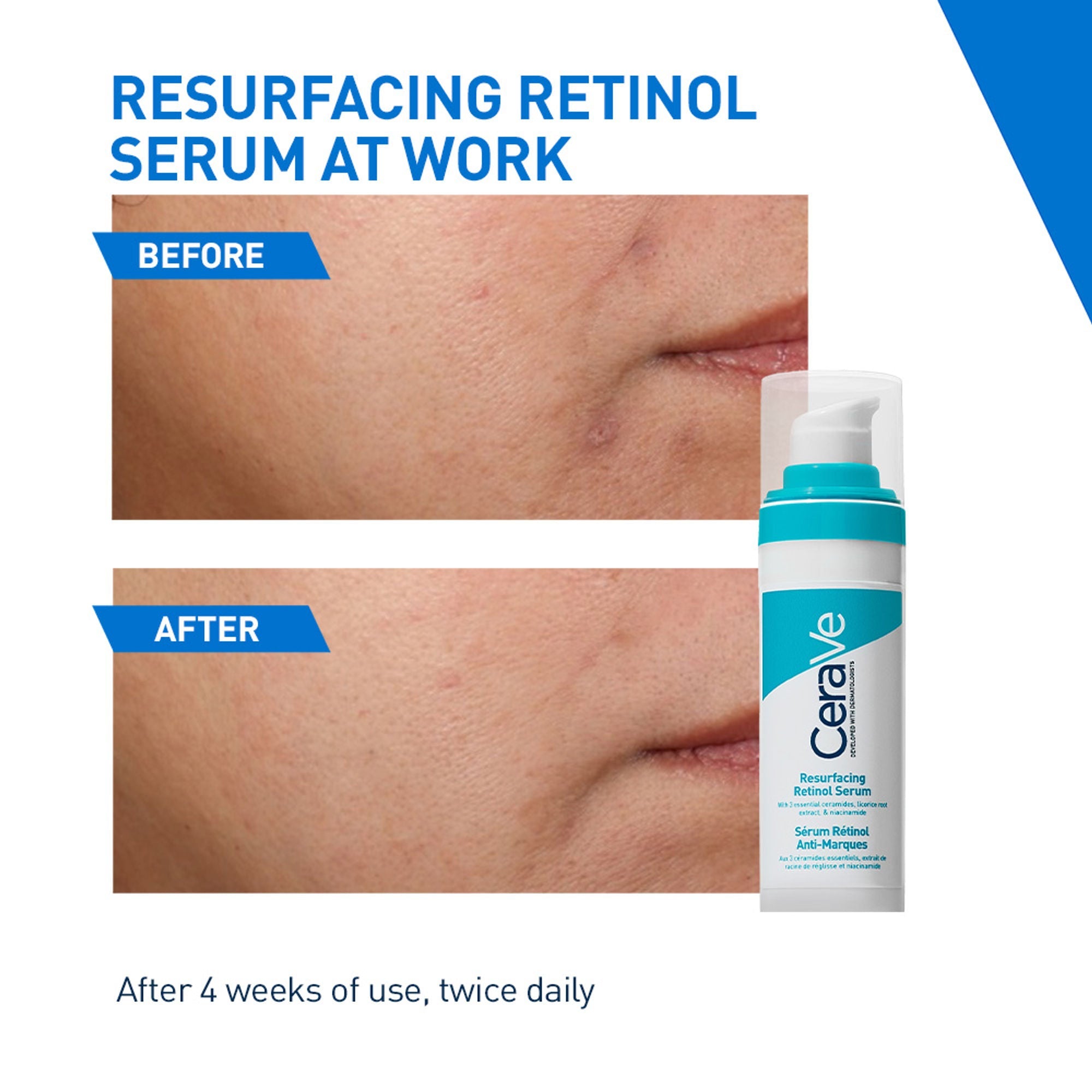 CeraVe Resurfacing Retinol Serum, Reduces Acne Marks with Licorice Root Extract & Niacinamide | Grocsy
